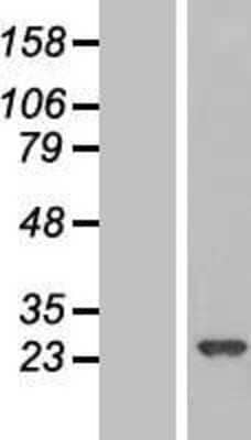 Western Blot: RPE Overexpression Lysate [NBL1-15494]