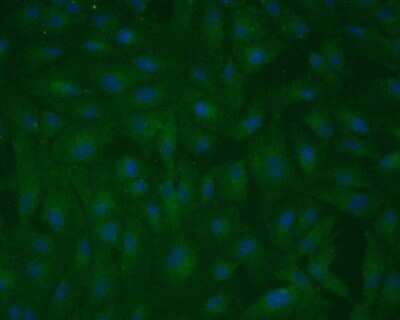 Immunocytochemistry/ Immunofluorescence: RPE65 Antibody (401.8B11.3D9) - Azide and BSA Free [NBP2-80931]