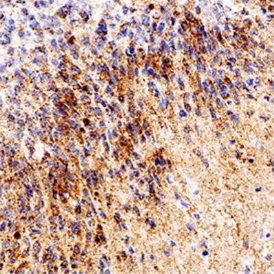 Immunohistochemistry-Paraffin: RPE65 Antibody (401.8B11.3D9) - Azide and BSA Free [NBP2-80931]