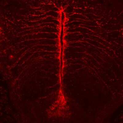Immunohistochemistry: RPE65 Antibody (401.8B11.3D9) - BSA Free [NB100-355]