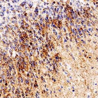 Immunohistochemistry-Paraffin: RPE65 Antibody (401.8B11.3D9) - BSA Free [NB100-355]