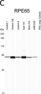 Simple Western: RPE65 Antibody (401.8B11.3D9)BSA Free [NB100-355]