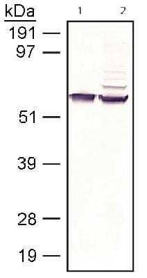 Western Blot: RPE65 Antibody (401.8B11.3D9)BSA Free [NB100-355]