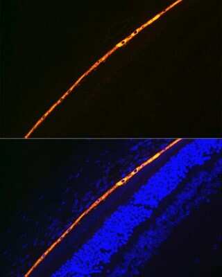 Immunohistochemistry: RPE65 Antibody (5X1F6) [NBP3-16840]
