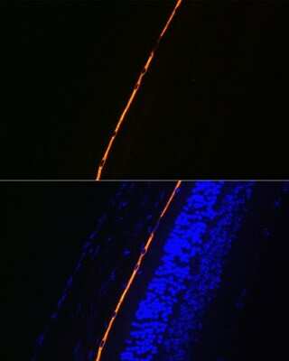 Immunohistochemistry: RPE65 Antibody (5X1F6) [NBP3-16840]