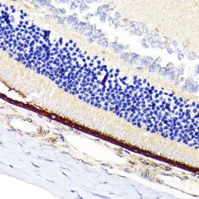 Immunohistochemistry-Paraffin: RPE65 Antibody (5X1F6) [NBP3-16840]