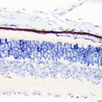 Immunohistochemistry-Paraffin: RPE65 Antibody (5X1F6) [NBP3-16840]