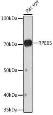 Western Blot: RPE65 Antibody (5X1F6) [NBP3-16840]