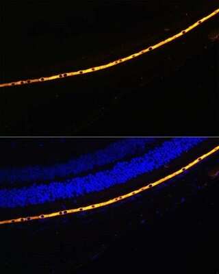 Immunohistochemistry: RPE65 Antibody - BSA Free [NBP2-95096]