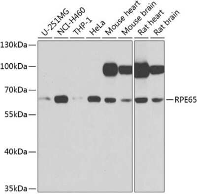 Western Blot: RPE65 AntibodyBSA Free [NBP2-95096]