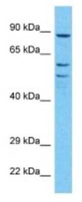 Western Blot: RPE65 Antibody [NBP3-10292]