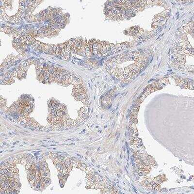 Immunohistochemistry-Paraffin: RPESP Antibody [NBP1-80814]