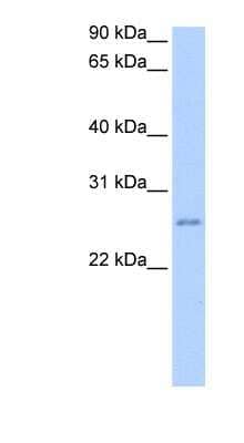 Western Blot: RPESP Antibody [NBP1-70697]