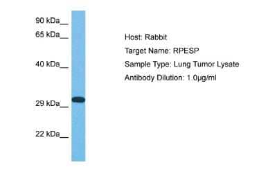 Western Blot: RPESP Antibody [NBP2-85654]