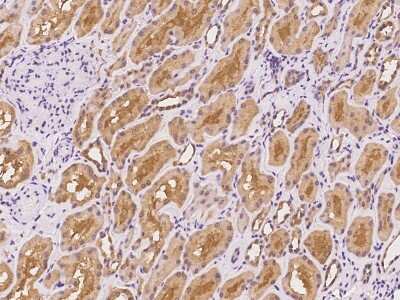 Immunohistochemistry: RPGR Antibody [NBP2-97791]