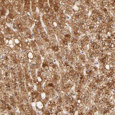 Immunohistochemistry-Paraffin: RPGR Antibody [NBP1-84412]