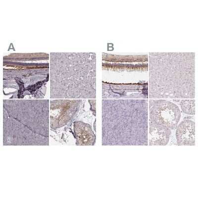 Immunohistochemistry-Paraffin: RPGRIP1 Antibody [NBP2-13249]