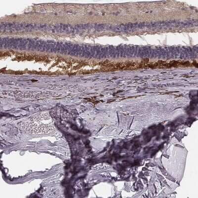 Immunohistochemistry-Paraffin: RPGRIP1 Antibody [NBP2-13249]