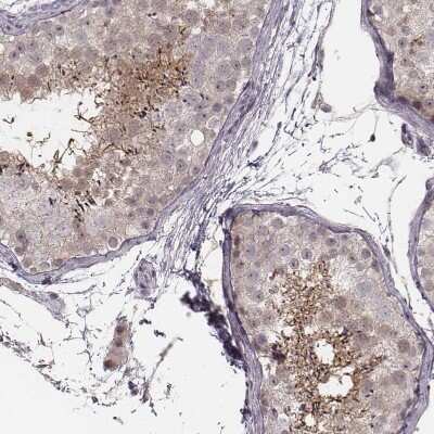 Immunohistochemistry-Paraffin: RPGRIP1 Antibody [NBP2-13249]