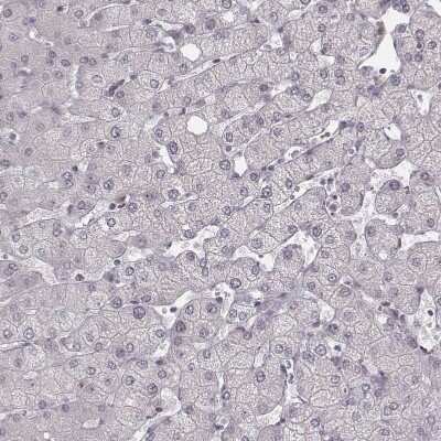 Immunohistochemistry-Paraffin: RPGRIP1 Antibody [NBP2-13249]