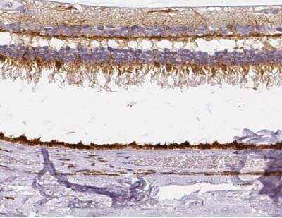 Immunohistochemistry-Paraffin: RPGRIP1 Antibody [NBP2-55753]