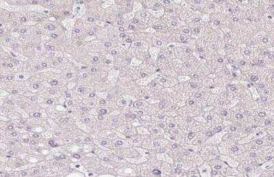 Immunohistochemistry-Paraffin: RPGRIP1 Antibody [NBP2-55753]