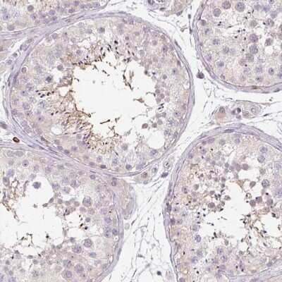Immunohistochemistry-Paraffin: RPGRIP1 Antibody [NBP2-55753]