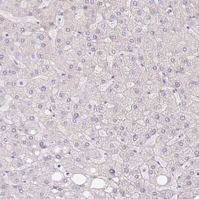 Immunohistochemistry-Paraffin: RPGRIP1 Antibody [NBP2-55753]