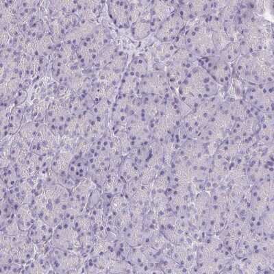 Immunohistochemistry-Paraffin: RPGRIP1 Antibody [NBP2-55753]