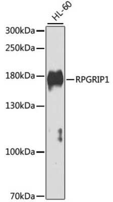 Western Blot: RPGRIP1 AntibodyAzide and BSA Free [NBP2-93166]