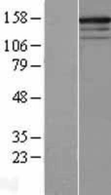 Western Blot: RPGRIP1 Overexpression Lysate [NBL1-15496]