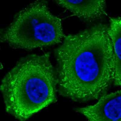 Immunocytochemistry/ Immunofluorescence: RPGRIP1L Antibody [NBP2-57686]