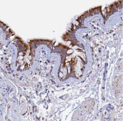 Immunohistochemistry-Paraffin: RPGRIP1L Antibody [NBP1-84403]