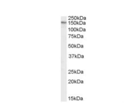 Western Blot: RPGRIP1L Antibody [NBP1-00236]