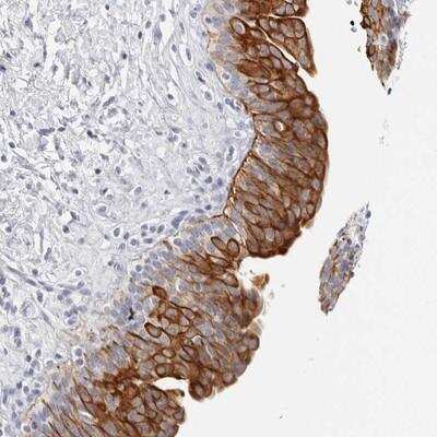 Immunohistochemistry-Paraffin: RPH3AL Antibody [NBP1-80991]