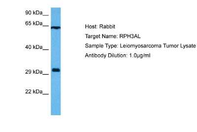 Western Blot: RPH3AL Antibody [NBP2-83466]