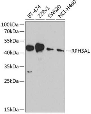 Western Blot: RPH3AL AntibodyBSA Free [NBP2-94887]