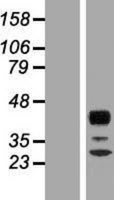 Western Blot: RPH3AL Overexpression Lysate [NBP2-07546]