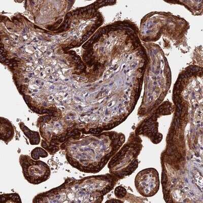 Immunohistochemistry-Paraffin: RPIA Antibody [NBP1-86214]