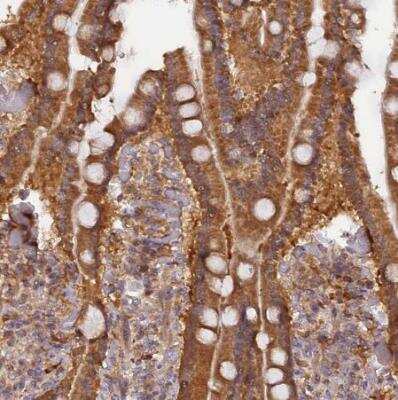 Immunohistochemistry-Paraffin: RPIA Antibody [NBP1-86214]