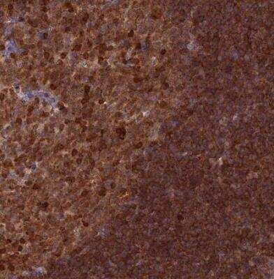 Immunohistochemistry-Paraffin: RPIA Antibody [NBP1-86214]