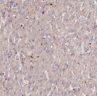 Immunohistochemistry-Paraffin: RPIA Antibody [NBP1-86214]
