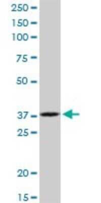 Western Blot: RPIA Antibody [H00022934-B01P]