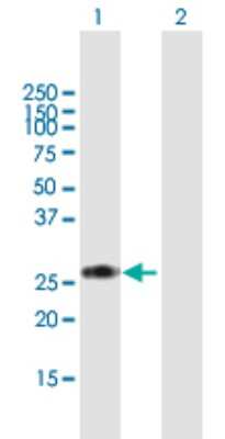Western Blot: RPIA Antibody [H00022934-B01P]
