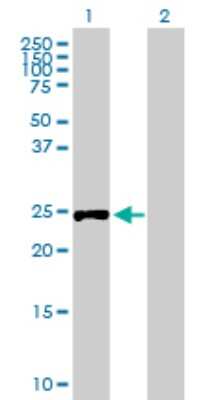 Western Blot: RPIA Antibody [H00022934-B02P]