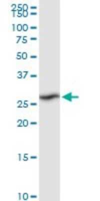 Western Blot: RPIA Antibody [H00022934-D01P]