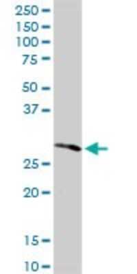 Western Blot: RPIA Antibody [H00022934-D01P]