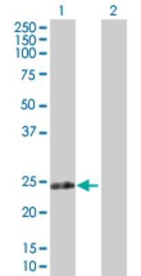 Western Blot: RPIA Antibody [H00022934-D01P]