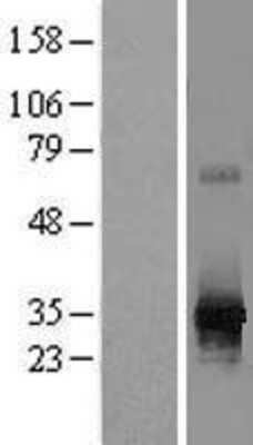 Western Blot: RPIA Overexpression Lysate [NBL1-15498]