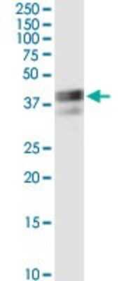 Western Blot: RPIP8 Antibody (1A8) [H00010900-M01]